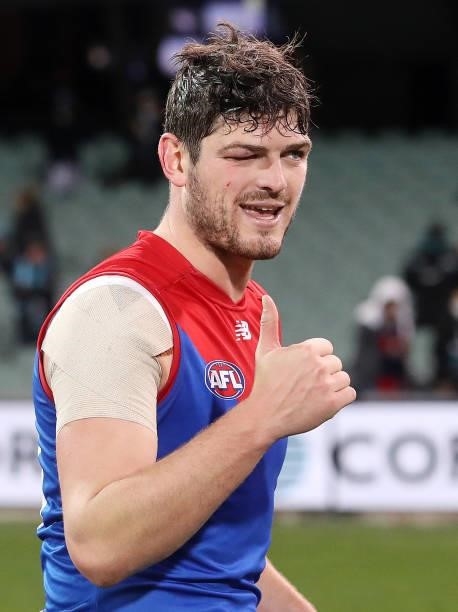 Angus Brayshaw of the Demons gives the thumbs up despite his right eye closed over. During the 2021 AFL Round 17 match between the Port Adelaide...