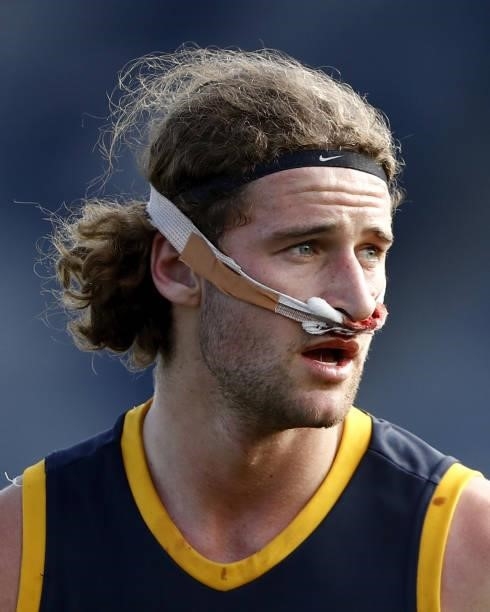 Sam Berry of the Crows looks on with his nose taped up during the 2021 AFL Round 20 match between the Western Bulldogs and the Adelaide Crows at Mars...