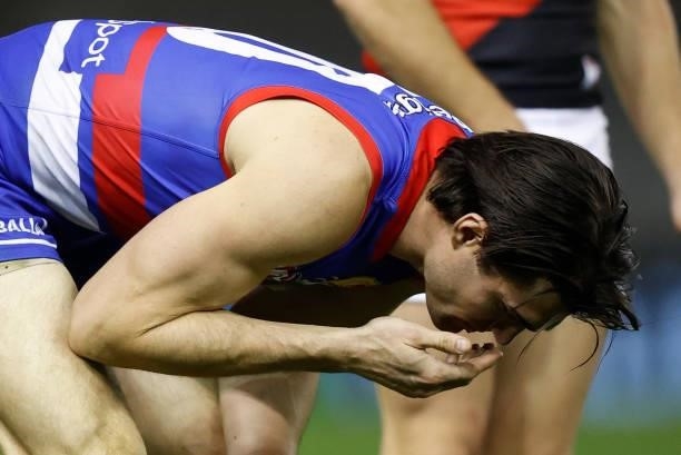 Easton Wood of the Bulldogs leaves the field under the blood rule during the 2021 AFL Round 21 match between the Western Bulldogs and the Essendon...