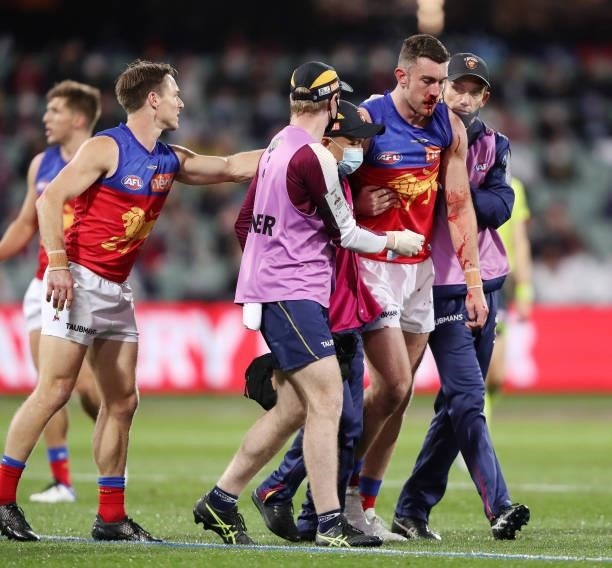 Daniel McStay of the Lions is assisted off the field during the 2021 AFL First Qualifying Final match between the Melbourne Demons and the Brisbane...