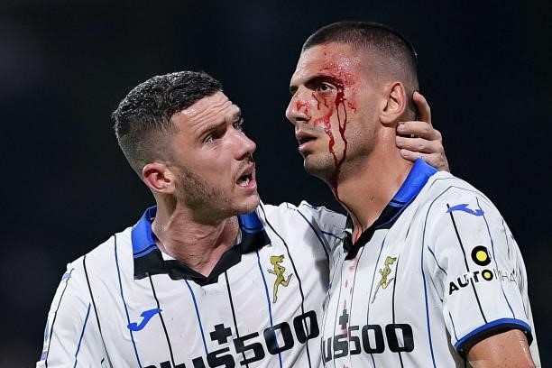 Merih Demiral of Atalanta BC has a bloody face after during the Serie A match between US Salernitana 1919 and Atalanta BC at Stadio Arechi, Salerno,...