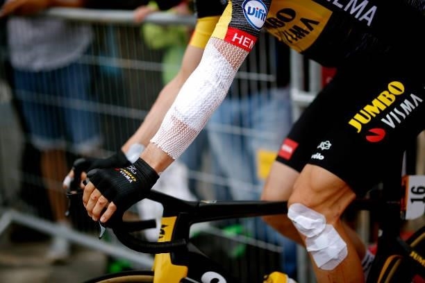 Tony Martin of Germany and Team Jumbo-Visma Injury at start during the 108th Tour de France 2021, Stage 2 a 183,5km stage from Perros-Guirec to...