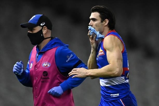 Easton Wood of the Bulldogs comes from the field with a cut mouth during the round 21 AFL match between Western Bulldogs and Essendon Bombers at...