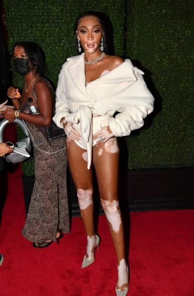 Winnie Harlow attends the 2021 MTV Video Music Awards at Barclays Center on September 12, 2021 in the Brooklyn borough of New York City.