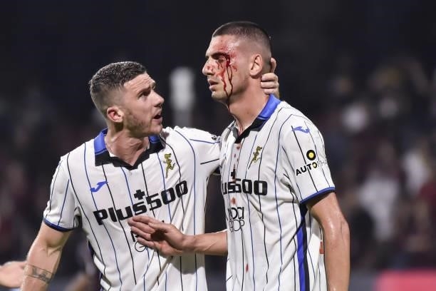 Merih Demiral of Atalanta BC as a bloody face during the Serie A match between US Salernitana v Atalanta BC at Stadio Arechi on September 18, 2021 in...