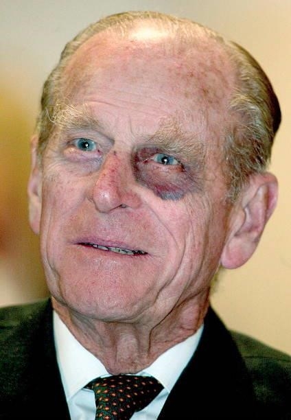 Prince Philip Sporting A Black-eye As He Tours The New Baglan Power Station In Port Talbot. The American Ge Plant Is Reputed To Be The Most Efficient...